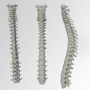 Three images showing spinal bones to talk about the importance of a healthy spine and my experience with bad posture.